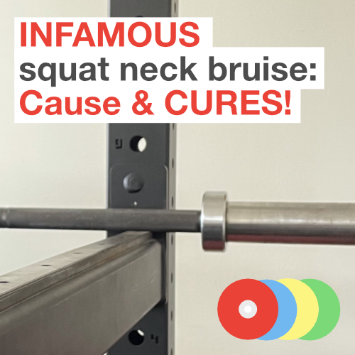 INFAMOUS squat neck bruise: Cause & CURES!